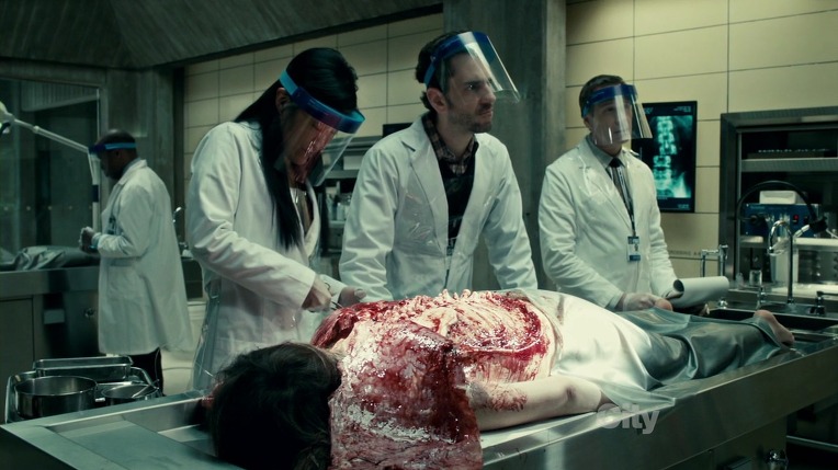 본격침샘어택미드 한니발(Hannibal) 시즌1 에피5 (2/4) *시체주의* | 인스티즈